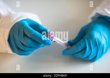 Processo di analisi del coronavirus da parte di un medico infermieristico in laboratorio, kit per il prelievo del tampone COVID-19, provetta per il prelievo del campione paziente OP NP samp Foto Stock