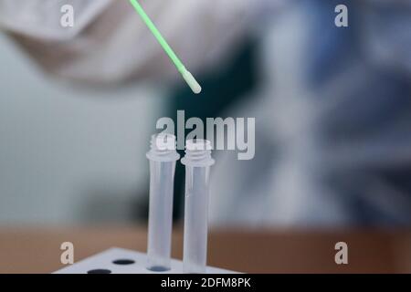 Il personale medico presenta il nuovo test sull'antigene Covid-19 a Bordeaux, Francia, il 5 novembre 2020. Gli studenti di medicina del campus di Carreire dell'Università di Bordeaux servono come cavie per il nuovo test dell'antigene Covid-19 a rapido risultato. Il test è positivo se vengono visualizzate due barre e negativo se viene visualizzata una sola barra. Foto di Thibaud Moritz/ABACAPRESS.COM Foto Stock