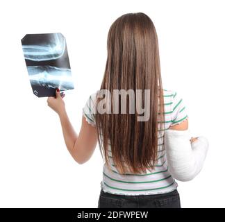 Giovane donna con braccio rotto che tiene l'immagine radiografica su bianco sfondo Foto Stock