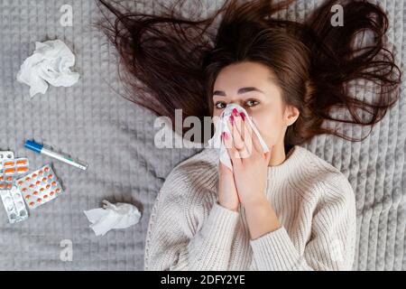 Il concetto di malattie e raffreddori stagionali. Una giovane donna di brunetta si stende sul letto con i capelli giù e le soffia il naso. Su non mentire pillole e altro Foto Stock