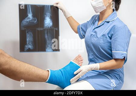 Medico femminile in un abito medico blu controllo gamba rotta e mostra il paziente maschile proiezione laterale x-ray di piede e caviglia. Foto Stock
