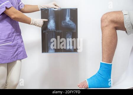 Medico femminile in un abito medico blu controllo gamba rotta e mostra il paziente maschile proiezione laterale x-ray di piede e caviglia. Foto Stock