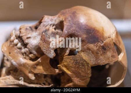 Cranio di Nakht un giovane operaio dell'antico Egitto. L'oggetto è visto nella mostra del Royal Ontario Museum chiamato 'Egyptian Mummies: Ancient Lives. Est Foto Stock