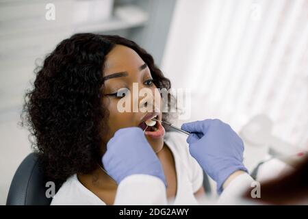 Primo piano - vista dall'alto dell'angolo del volto di una paziente donna africana attraente che viene controllata dal dentista in clinica. Dentista femminile che esamina un paziente con gli attrezzi Foto Stock