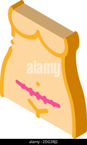 sezione cesareo icona isometrica colore dell'illustrazione vettoriale Illustrazione Vettoriale