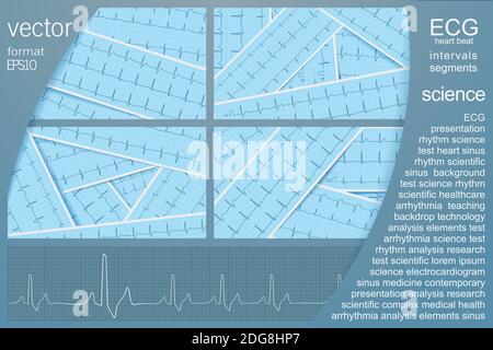 Set di sfondo vettoriale ECG con diversi cardiogrammi realistici con ritmo sinusale per la progettazione di coperture mediche e mediche. EPS10 modificabile. Illustrazione Vettoriale