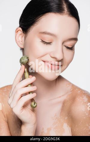 sorridente giovane bella donna con vitiligine utilizzando rullo di giada su faccia isolata su bianco Foto Stock