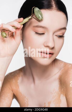 giovane bella donna con vitiligine utilizzando rullo di giada sul viso isolato su bianco Foto Stock