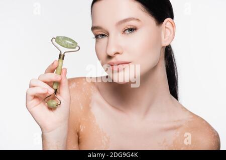 giovane bella donna con vitiligo che tiene rullo di giada sul viso isolato su bianco Foto Stock