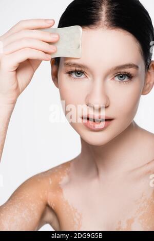 giovane bella donna con vitiligine usando gua sha isolato su bianco Foto Stock