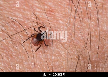 Zecke, Holzbock, Zecken, auf Haut, Mensch, Ixodes ricinus, tick di fagiolo di ricino, tick di fagiolo di ricino europeo, tick di pecora europeo, tick, zecche Foto Stock