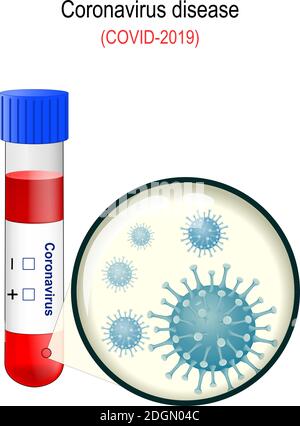 Coronavirus. 2019-nCoV malattia respiratoria acuta. COVID-19. Icona del virus corona. Cina patogeno infezione respiratoria. Nuova polmonite da coronavirus (NCP) Illustrazione Vettoriale