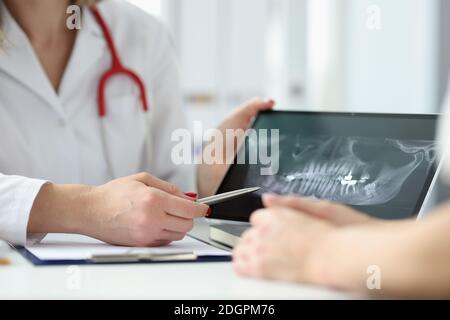 Dentista che mostra la compressa del paziente con raggi X dei denti in clinica primo piano Foto Stock