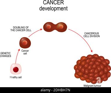 Cellula di cancro. Illustrazione che mostra lo sviluppo di malattia di cancro. Diagramma vettoriale per la progettazione, l'istruzione, la scienza e l'uso medico Illustrazione Vettoriale