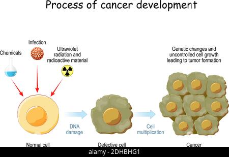 processo di sviluppo del cancro. Agenti che causano il cancro e le fasi di trasformazione della cellula normale in cellule difettose e cancro. Cambiamenti genetici Illustrazione Vettoriale