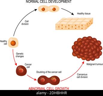 Cellule tumorali e cellule normali. Tessuto sano e tumore maligno. Illustrazione che mostra lo sviluppo di malattie tumorali. Diagramma vettoriale per il progetto Illustrazione Vettoriale