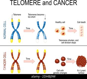 Cromosoma e telomero per cellule sane e cancerose. In una cella normale ogni volta che una cella si divide, i telomeri diventano più corti. Nelle cellule tumorali Illustrazione Vettoriale