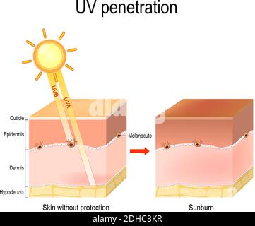 penetrazione uv negli strati della pelle umana. I raggi UVB non penetrano nella pelle in profondità, poiché sono bloccati dall'epidermide. UVA penetrano Illustrazione Vettoriale