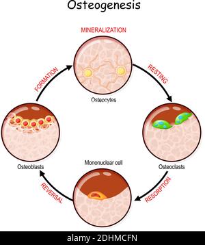 rimodellamento osseo (riposo, riassorbimento, inversione, mineralizzazione, formazione). Descrivere un processo di ossificazione. Osteogenesi. L'osso è scomposto Illustrazione Vettoriale