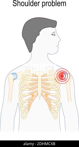 Problema di spalla. Silhouette umana con spalla evidenziata (colore rosso). Illustrazione vettoriale per la progettazione, l'istruzione, la biologia, l'uso scientifico Illustrazione Vettoriale