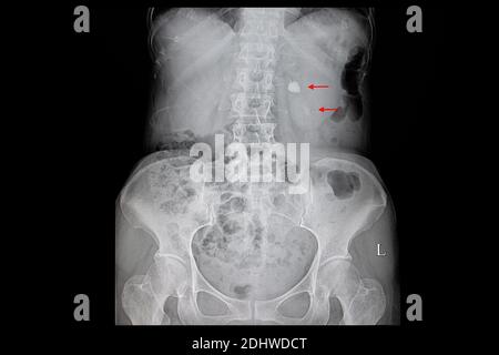 Organi, e anatomia umana, scheletro, sistema linfatico pelvico. Questa  illustrazione rappresenta l'anatomia generale in una sagoma maschile in  posi anatomici Foto stock - Alamy