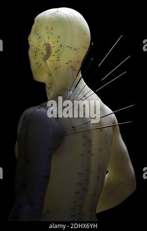 modello di agopuntura maschile con aghi nella spalla sinistra contro sfondo nero Foto Stock