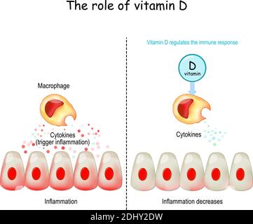 Vitamina D, sistema immunitario e COVID-19. La vitamina D regola la risposta immunitaria. Tempesta di citochine. COVID-19 complicanze. Differenza e confronto Illustrazione Vettoriale