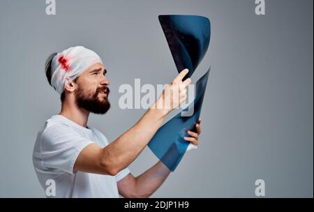 un uomo con un modello chirurgico di rianimazione del sangue della testa con bendaggio garza sul braccio Foto Stock