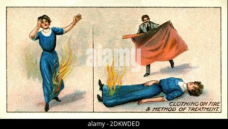 Carte di sigarette antiche. Sigarette di Wills (serie di pronto soccorso ). Abbigliamento su Fire, Inghilterra. 1913 Foto Stock