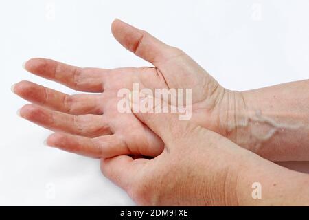 Una donna ha dolore nelle mani e le dita soffre dalla pelle asciutta Foto Stock
