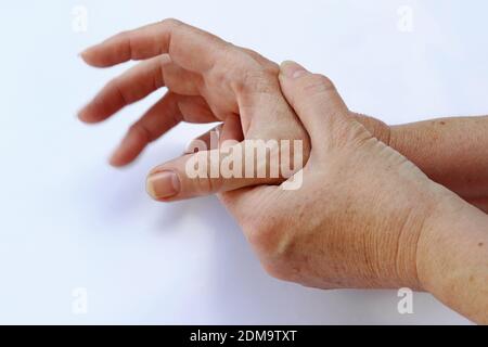 Le mani di una donna con malattia di Parkinson tremano molto fortemente Foto Stock