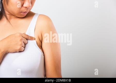 Primo piano di donna asiatica che punta la sua pelle ascella problema ascella grasso ascellare pelle rugosa, problema ascella pelle, studio isolato su bianco backgr Foto Stock