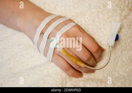 Infusione endovenosa. Terapia di infusione. Mano femminile e ago contagocce in vena. L'infusione endovenosa è una manipolazione medica Foto Stock