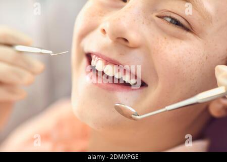 Primo piano sorridente bambino ragazzo check-up in ufficio dentista. Prevenzione delle carie e trattamento dentale. Foto Stock