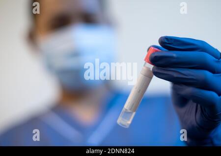 Lo scienziato tiene il campione medico nella provetta Foto Stock