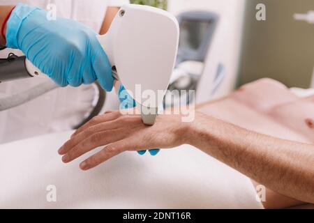 Ripresa ritagliata di un cosmetologo che rimuove i capelli dalla mano di un cliente maschile, utilizzando un dispositivo laser per la rimozione dei capelli Foto Stock