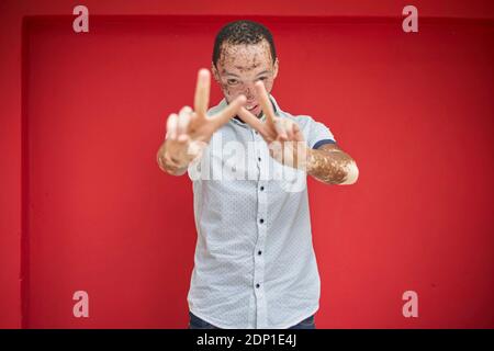 Giovane con vitiligo che fa il segno della vittoria davanti ad un muro rosso Foto Stock