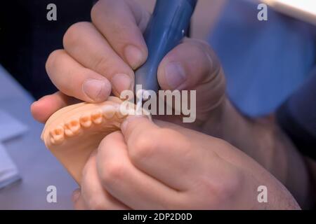 Tecnico dentale che lavora con protesi dentarie - vista ravvicinata Foto Stock