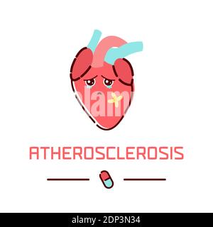 Aterosclerosi, illustrazione concettuale. Foto Stock