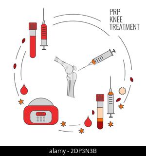 Platelet-rich plasma knee treatment, illustration. Stock Photo