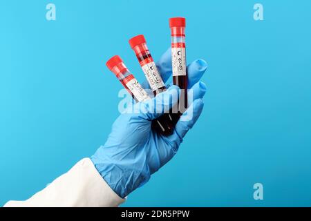 Analisi del sangue, sangue in una provetta, ricerca di anticorpi, analisi della presenza di anticorpi Covid-19 Foto Stock