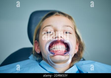 Ritratto di giovane paziente in studio dentistico. Ragazza durante l'esame dentale. Foto Stock
