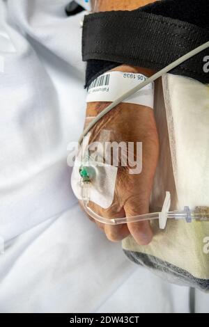 nella mano di un paziente in funzione è presente una cannula venosa per infusione Foto Stock