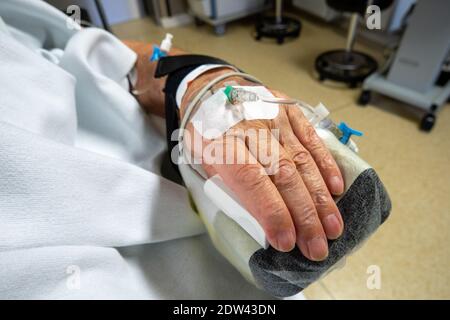 nella mano di un paziente in funzione è presente una cannula venosa per infusione Foto Stock