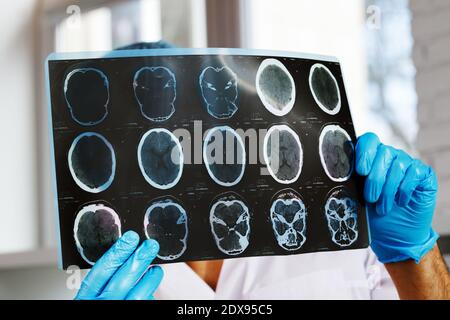 Il medico di sesso maschile esamina la risonanza magnetica cerebrale di un paziente Foto Stock