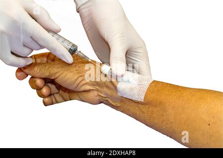 Siringa a pressione del medico nel tappo eparina mano del paziente Foto Stock
