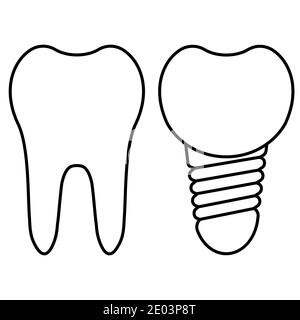 Chirurgia dentale. Taglio dell'impianto e dente sano. Corona di impianto dentale vettoriale realistica. Elementi stomatologici Illustrazione Vettoriale