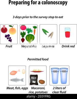 Preparazione per una colonscopia. Dieta per la colonscopia. Illustrazione vettoriale su sfondo isolato Illustrazione Vettoriale