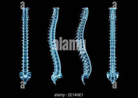 Colonna vertebrale o colonna vertebrale umana a raggi X da vari angoli isolati su sfondo nero rappresentazione 3D. Immagini mediche e anatomiche. Foto Stock