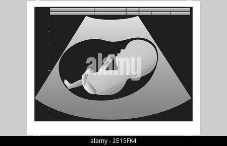 Ecografia del bambino non nato nell'utero delle madri. Illustrazione vettoriale. Illustrazione Vettoriale